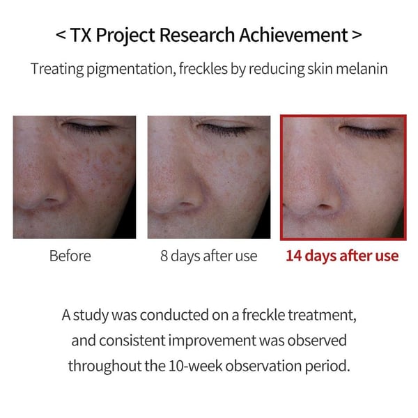 ✨Limited Time Offer✨ TX Cream -for Dark Spots & Hyperpigmentation