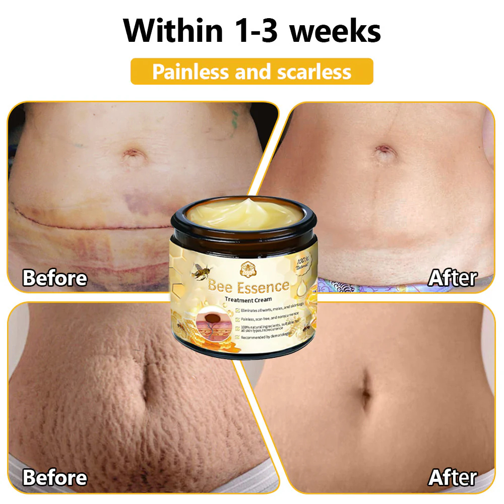 BENDCHARGE™ Bee Essence Skin Treatment Cream (AAD Recommended👨‍⚕️)