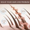 🔥Last Day Promotion 50% OFF🔥Hair Growth Serum