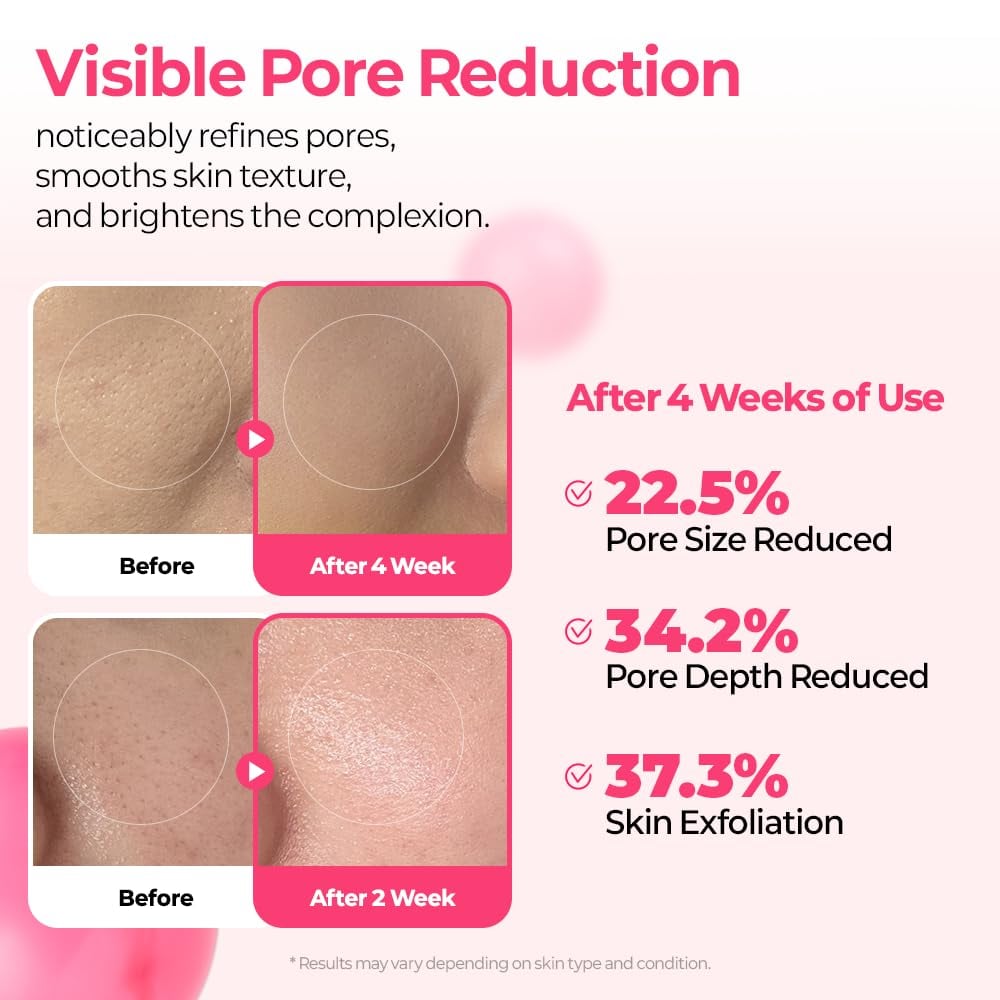🔥LAST DAY SALE 50% OFF🔥Pore & Spot Care Duo