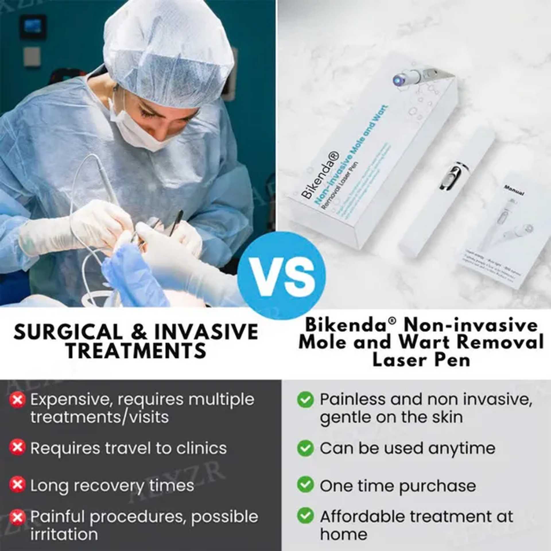 🔥Last Day Promotion 50% OFF💥Non-Invasive Mole and Wart Removal Laser Pen⚡️BUY 2 FREE SHIPPING
