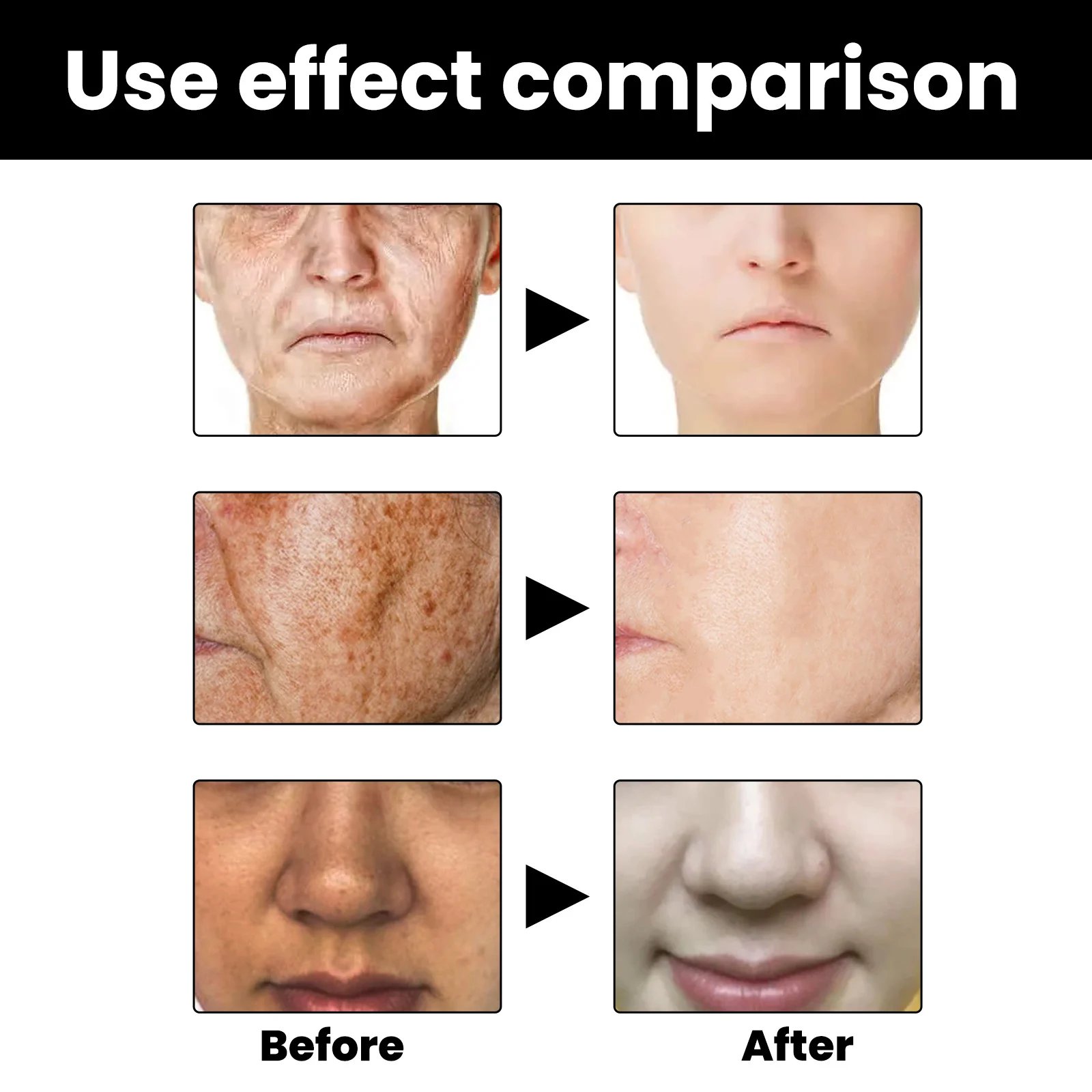🔥LAST DAY -49%OFF🔥 - Melanin Correcting Facial Serum