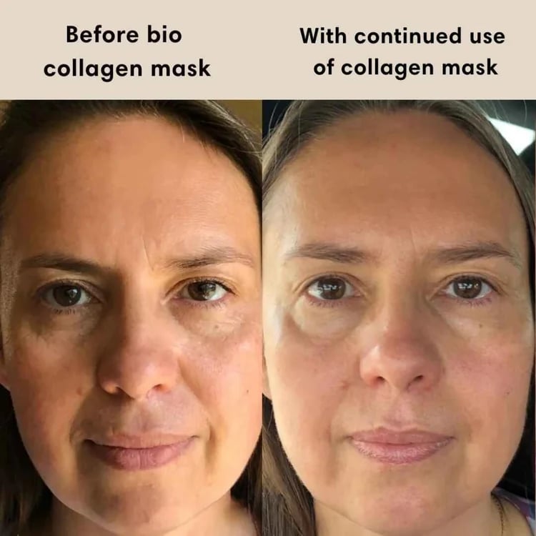 🔥Last Day Promotion 70% OFF🔥Collagen Night Wrapping Mask⚡Buy 3 Get 1 Free