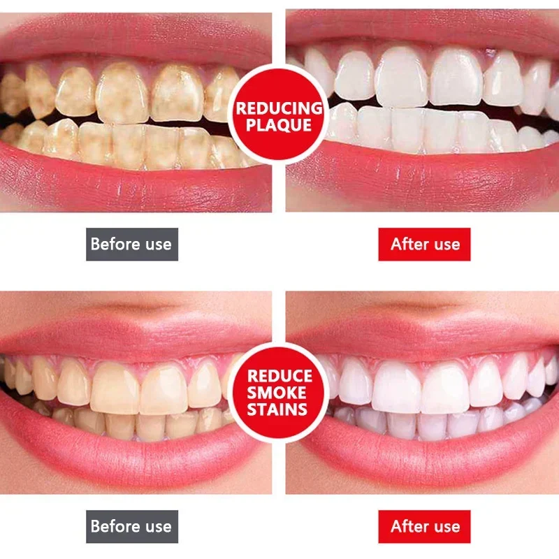 (🔥Last Day Promotion 50% OFF)🦷YAYASHI SP-4™ Probiotische Whitening-Zahnpasta 🥰