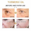 🔥2023 HOT SLAE 50% OFF🎁Turmeric Spot Correcting Serum