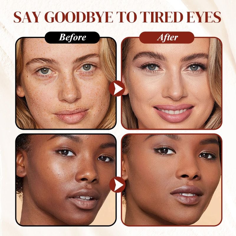🔥Last Day 49% OFF 💥Magic Under-Eye Corrector