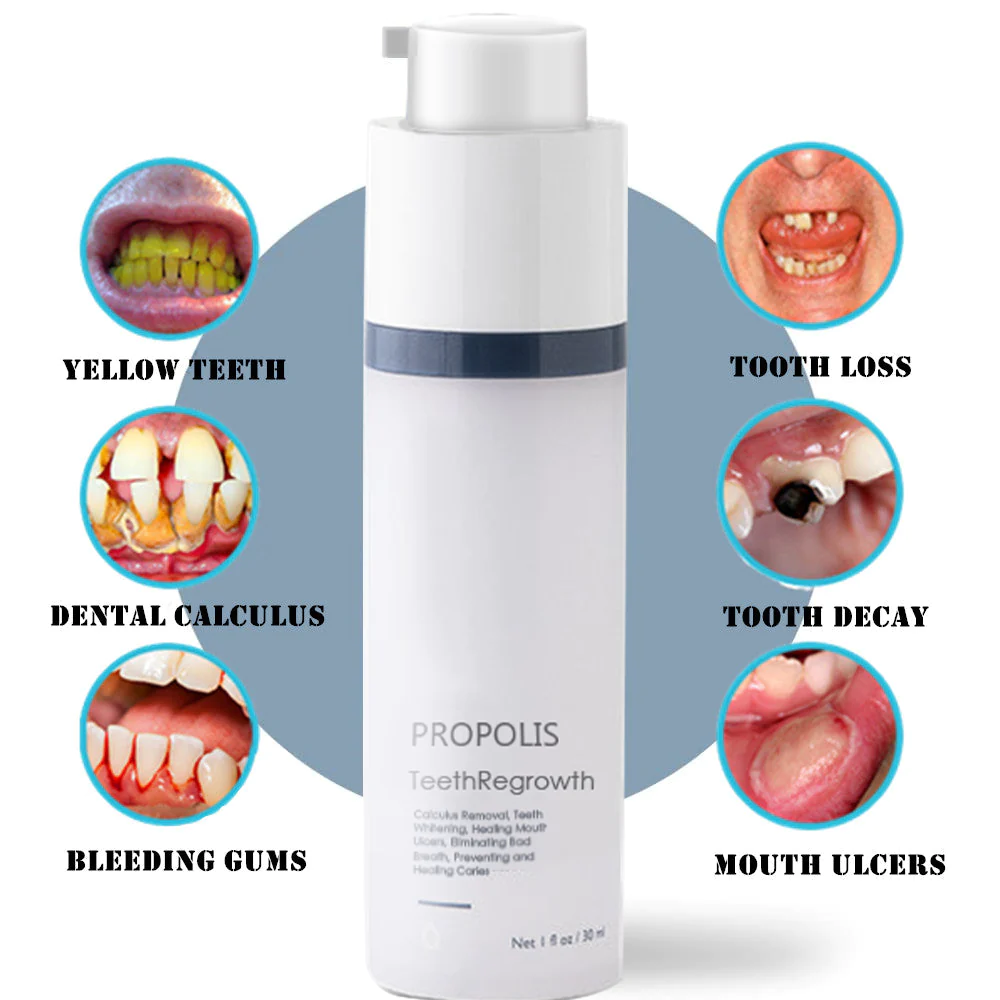 🔥Last Day Promotion-70% OFF-PROPOLIS Tooth Regeneration Gel (For all kinds of oral problems,especially teeth regeneration）