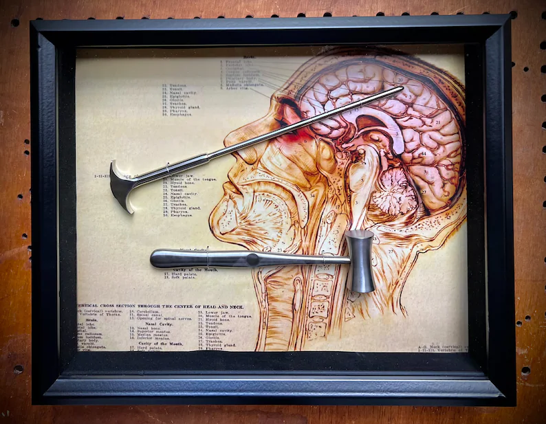 Lobotomy Shadowbox Display