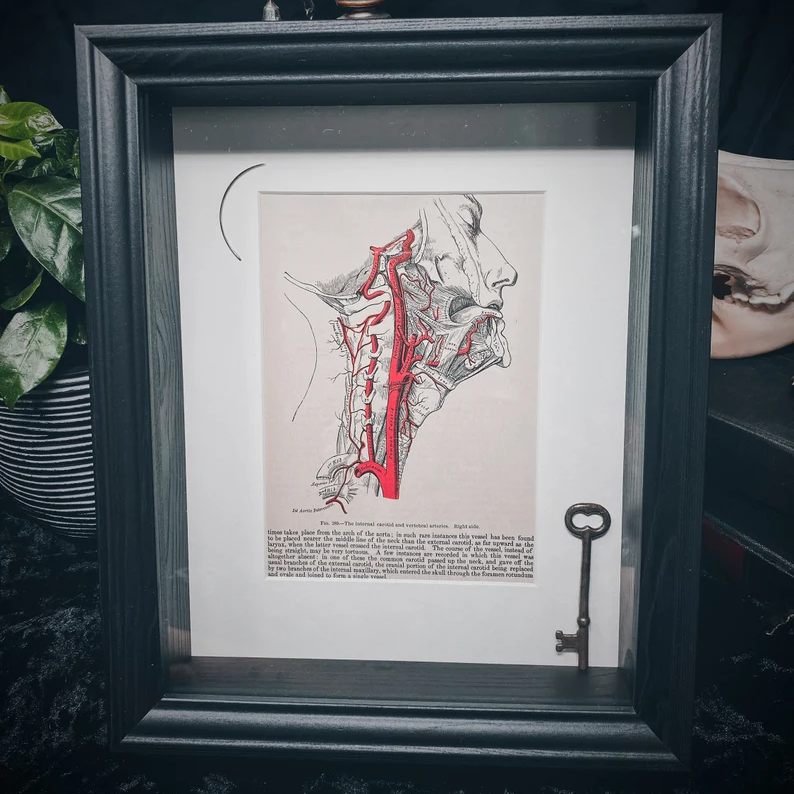 Lobotomy Shadowbox Display