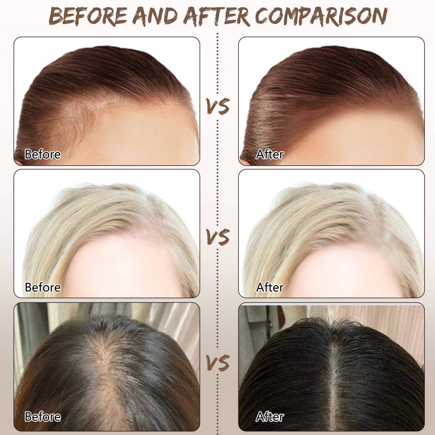 🔥 Hot Deal: Buy 2 Get Free Shipping! 🚚💨Elegance Edge Hairline Concealer