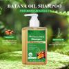 🎉Batanaöl-Shampoo mit Rosmarinextrakt
