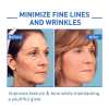 ⏰Last Day Discount 70% Off -💥 Botox Face Serum