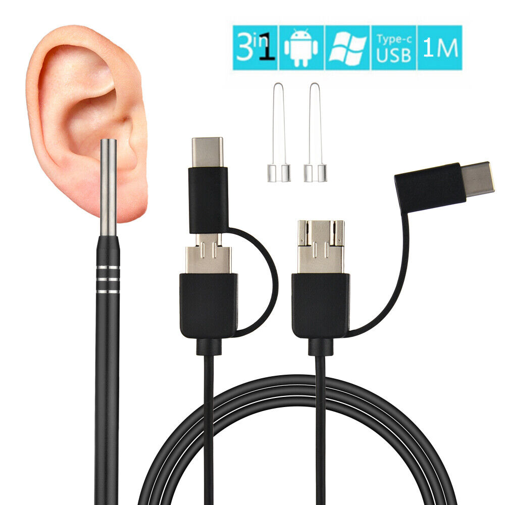 (🌲Early Christmas Sale- SAVE 48% OFF)3 In 1 Ear Cleaner Digital Otoscope(BUY 2 GET 1 FREE NOW)