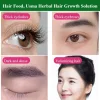 🔥Last Day Promotion 80% OFF🔥[Eyebrows Growth And Good Luck] Xinjiang Pure Usma Grass Juice Hair Growth Liquid