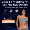 Dual Action Real Deep Collagen Sheets for both wrinkle smoothing and new or old scar fading