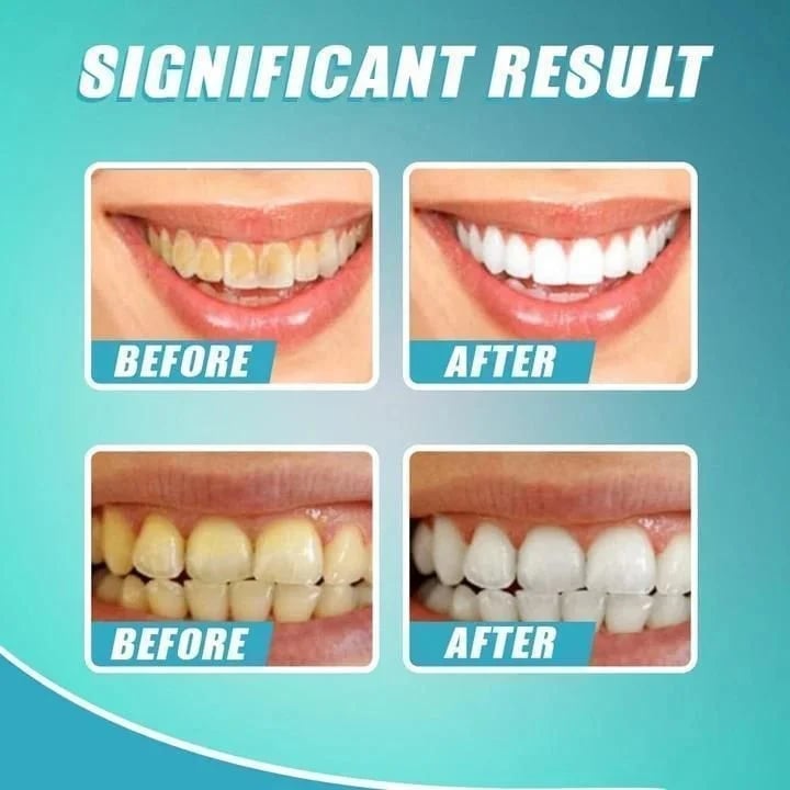 🔥Last Day Promotion 50% OFF🔥Intensive Stain Removal Whitening Toothpaste