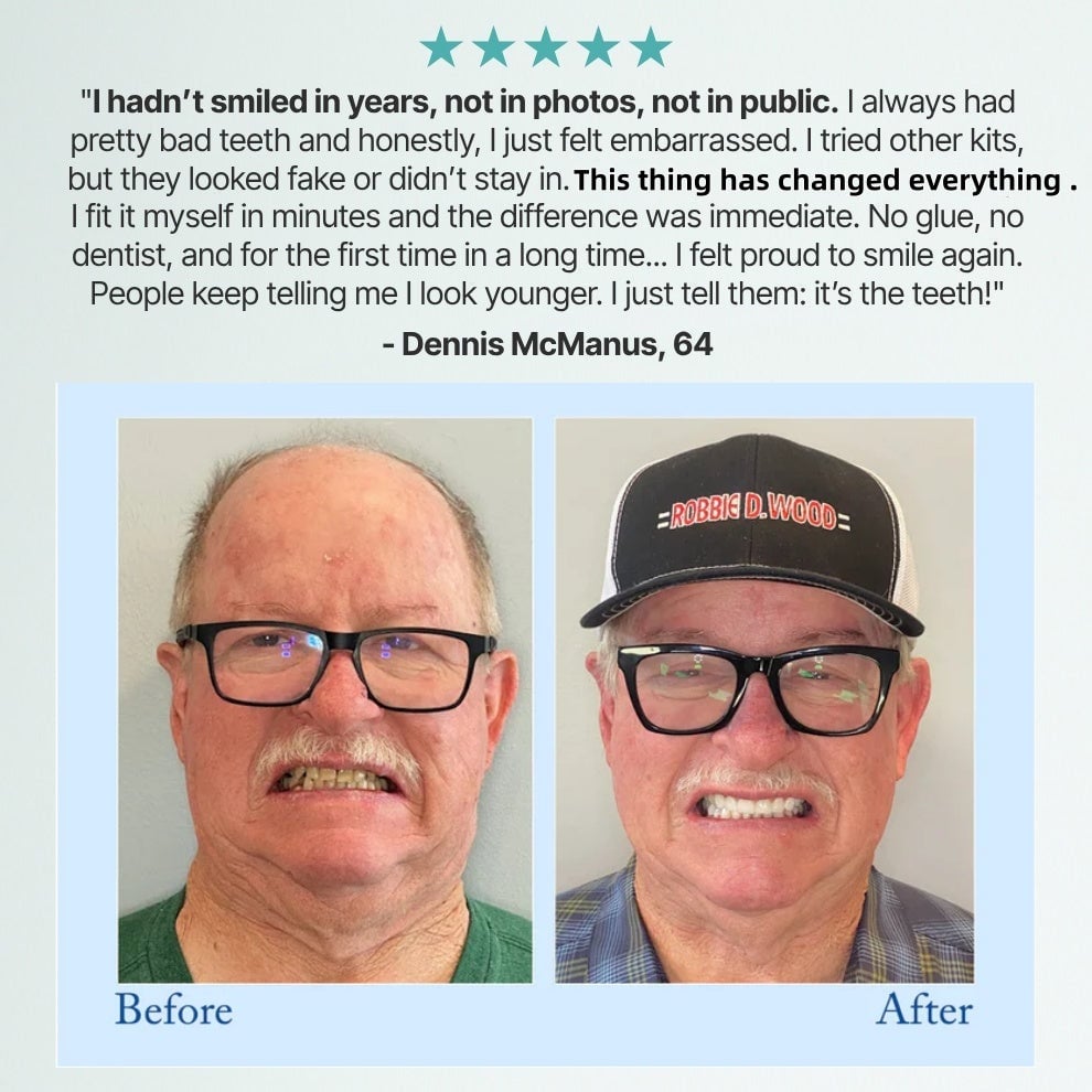 🦷Advanced Customized Full Denture Set🦷 (🔥10,000+ Sold In Last 30 Day)