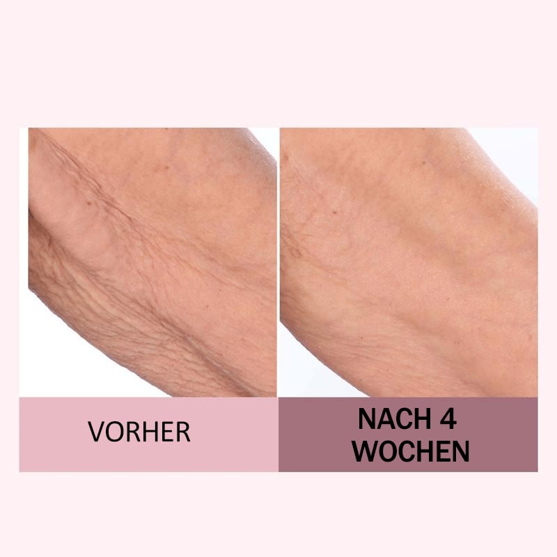 🏆Letzter Tag 49% RABATT🧴Lift Straffende Körpercreme(237 ml)