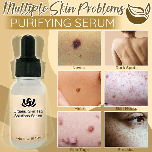 🔥Limited Time Sale 48% OFF🎉Organic Skin Spot Purifying Serum