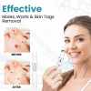 🔥Last Day Promotion 50% OFF💥Non-Invasive Mole and Wart Removal Laser Pen⚡️BUY 2 FREE SHIPPING
