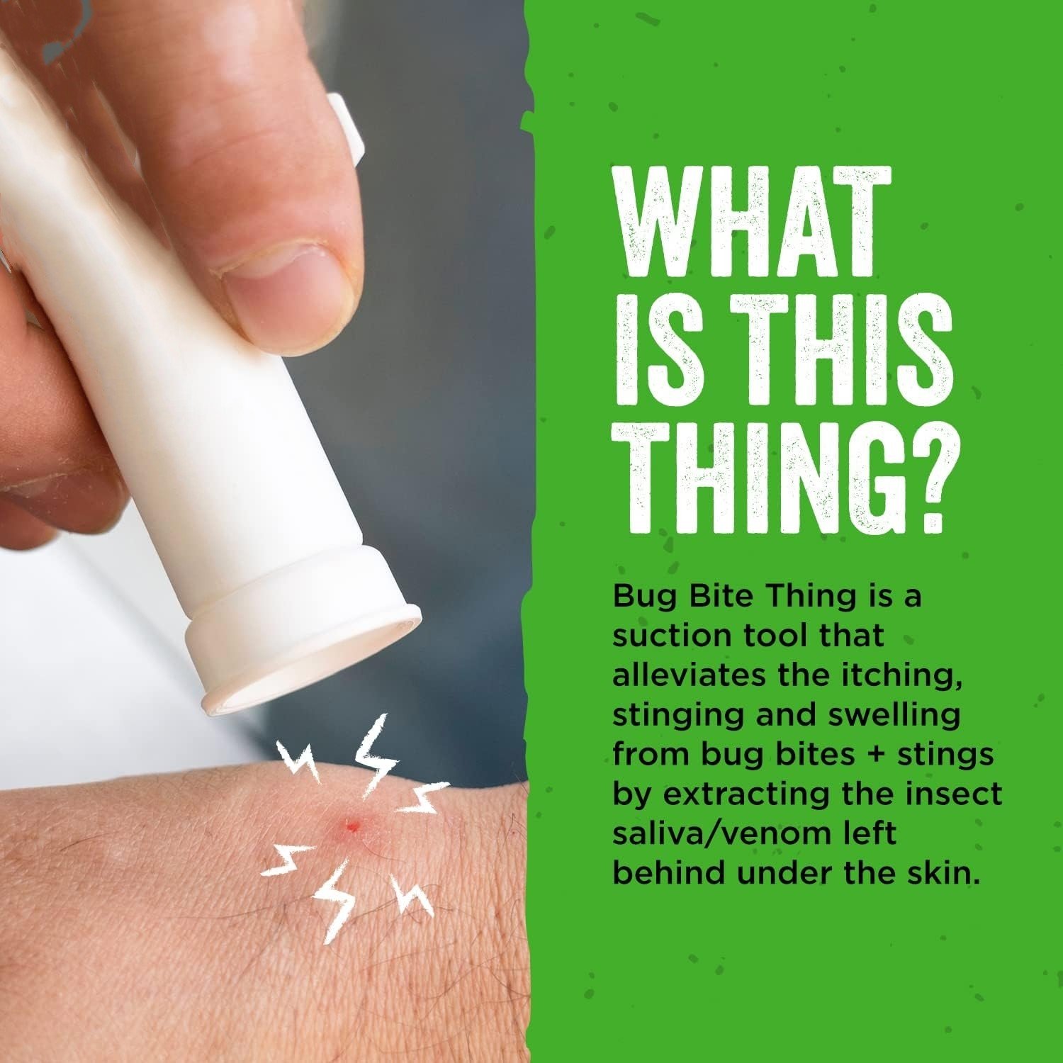 🎁TikTok Last Day Sale - 70% OFF🔥Bug Bite Suction Tool🦟 - Relieve itching and swelling✅