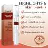 🔥Last Day Promotion 50% OFF🔥Tags & Moles Remover - Buy 2 Get 1 Free & Free Shipping