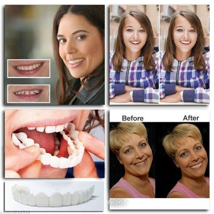 💝Last day discount-75%Off💝Latest👨‍⚕Adjustable Snap-On Dentures😁