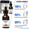 Last Day Promotion 70% OFF - 🔥Botox Face Serum