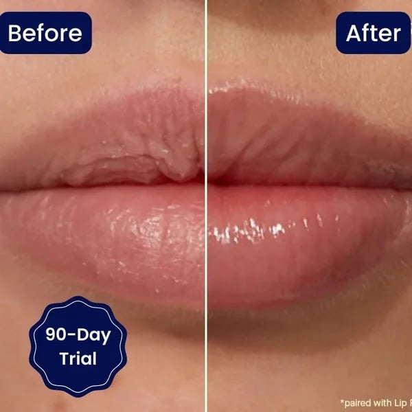 😍BIG SALE 🔥VITAMIN E LIP SERUM