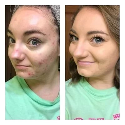 🔥🔥Tricolor Concealer