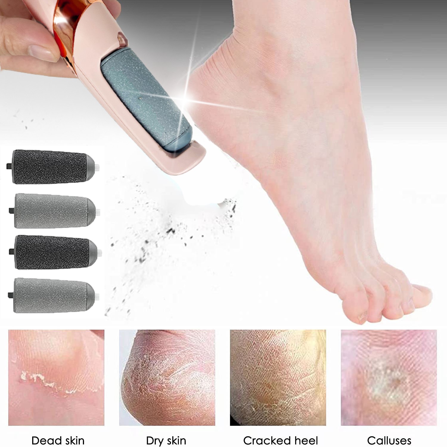 🔥Limited Time Sale 48% OFF🎉Electric Pedicure Callus Removal(Buy 2 get free shipping)