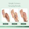 Peach Foot Peel Mask - Dermatologist Tested
