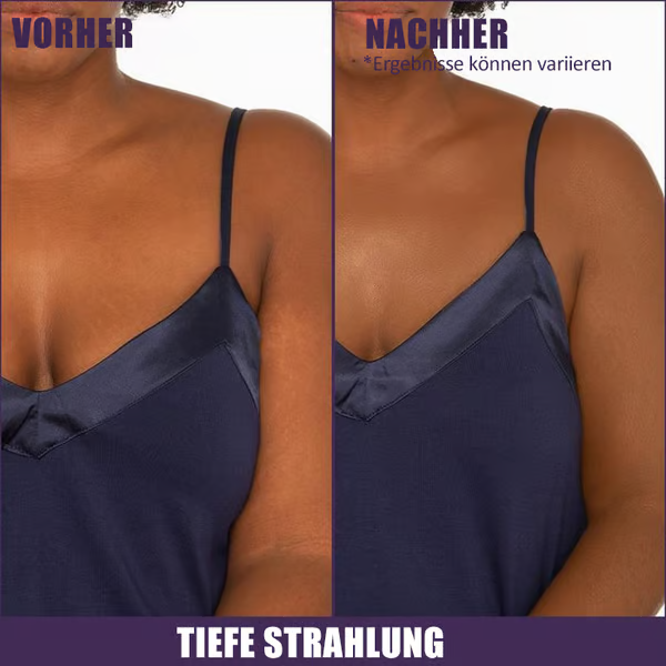 🔥LETZTER TAG 49 % RABATT🌟Körper-Concealer-Perfektionscreme – Feuchtigkeitsspendend, langanhaltend, leicht und wasserfest, 4 in 1💧✨