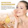 (Made and Shipped from USA) 🧑‍⚕️NEGUSY® Botox Bee Venom Wrinkle Removal Cream