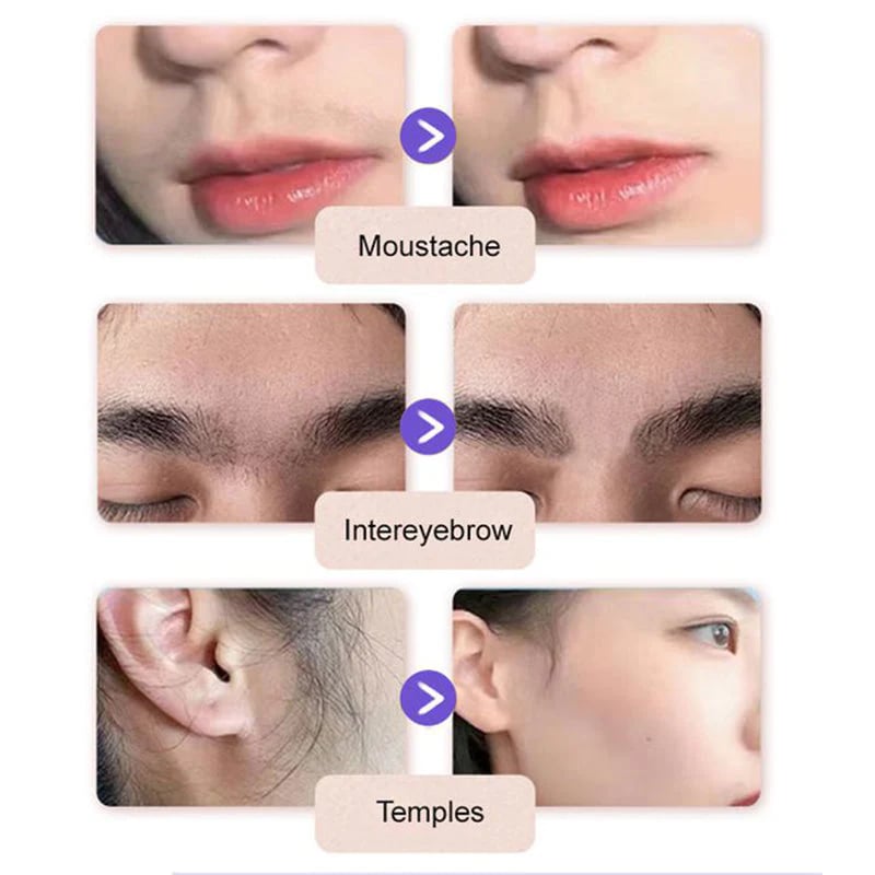 🎁TikTok Last Day Sale - 70% OFF🔥Gentle and Painless Facial Hair Removal Cream