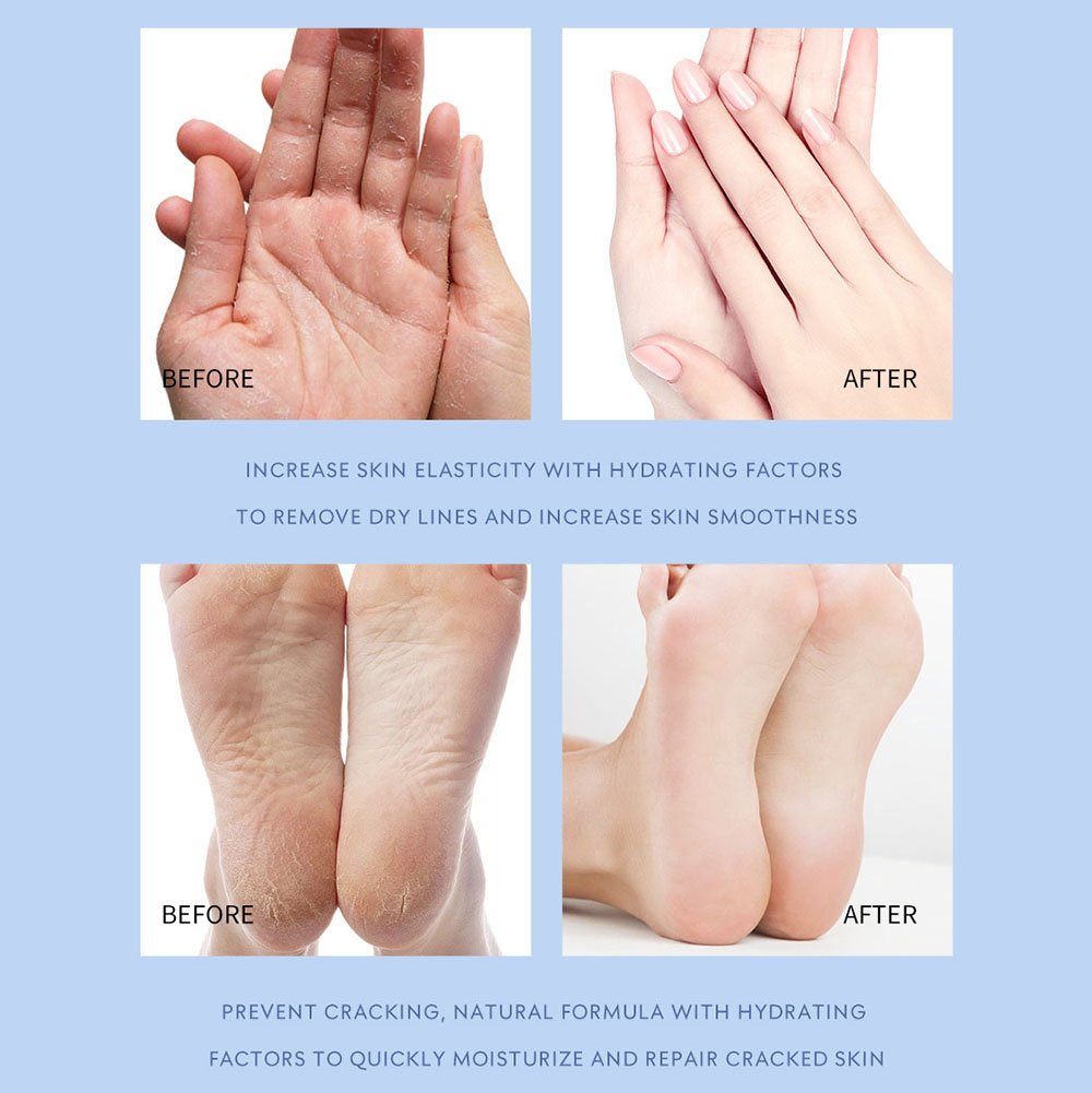 💥LAST DAY SALE 50% OFF💥Foot Moisturising Stick