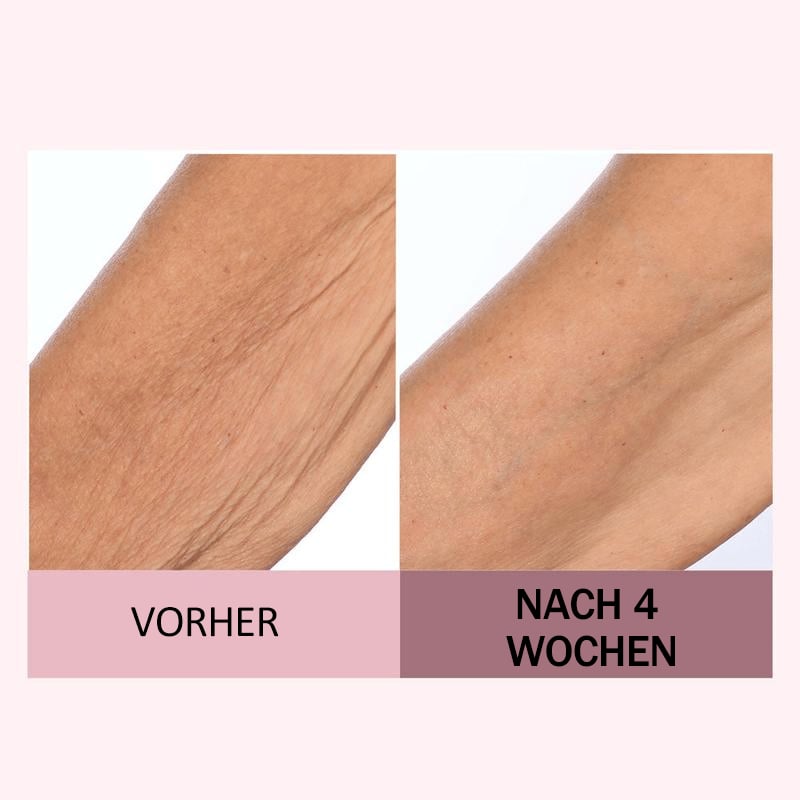 🏆Letzter Tag 49% RABATT🧴Lift Straffende Körpercreme(237 ml)