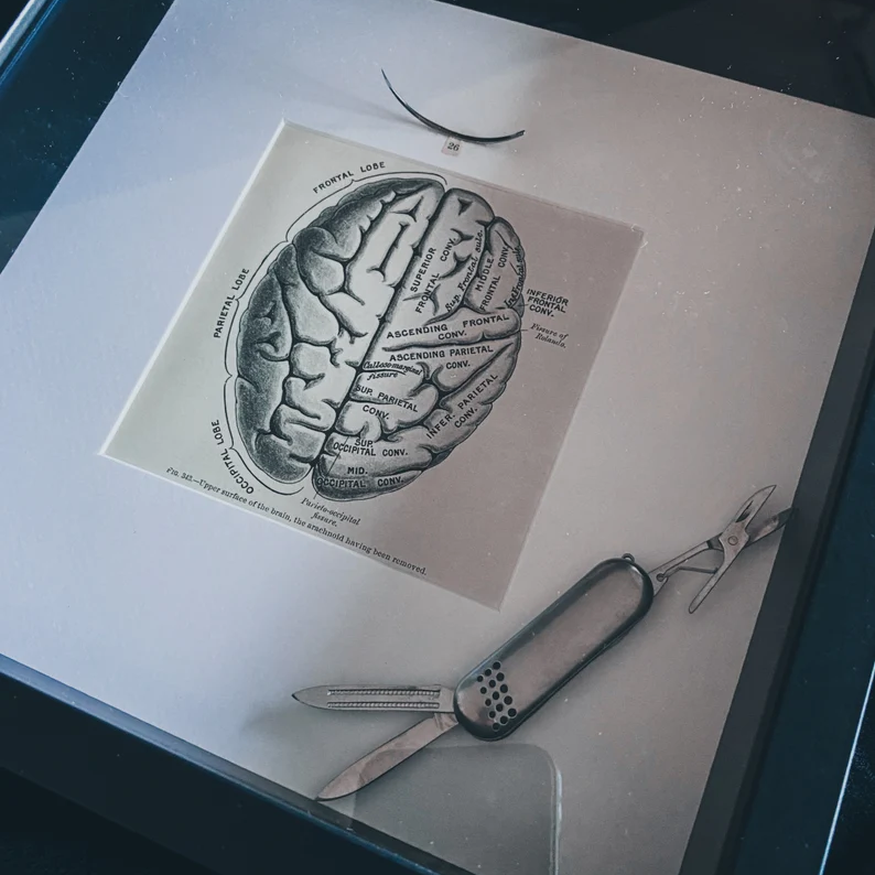 Lobotomy Shadowbox Display