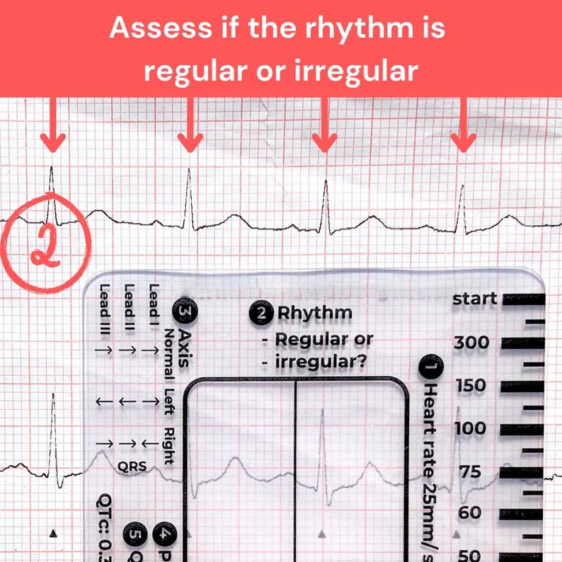 (🌲Early Christmas Sale- 49% OFF) ECG 7 Step Ruler - ECG Assessment Tool