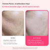 🔥Sonderangebote dieser Woche🔥Lumi Pore & Spot Care Duo