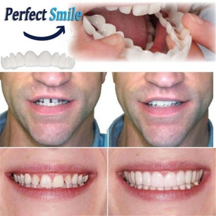 Latest👨‍⚕Adjustable Snap-On Dentures😁 (💥50% OFF) - 🔥HOT SALE🔥🎉