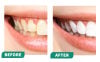 ⏰LAST DAY SALE 50% OFF💥Tooth whitening powder