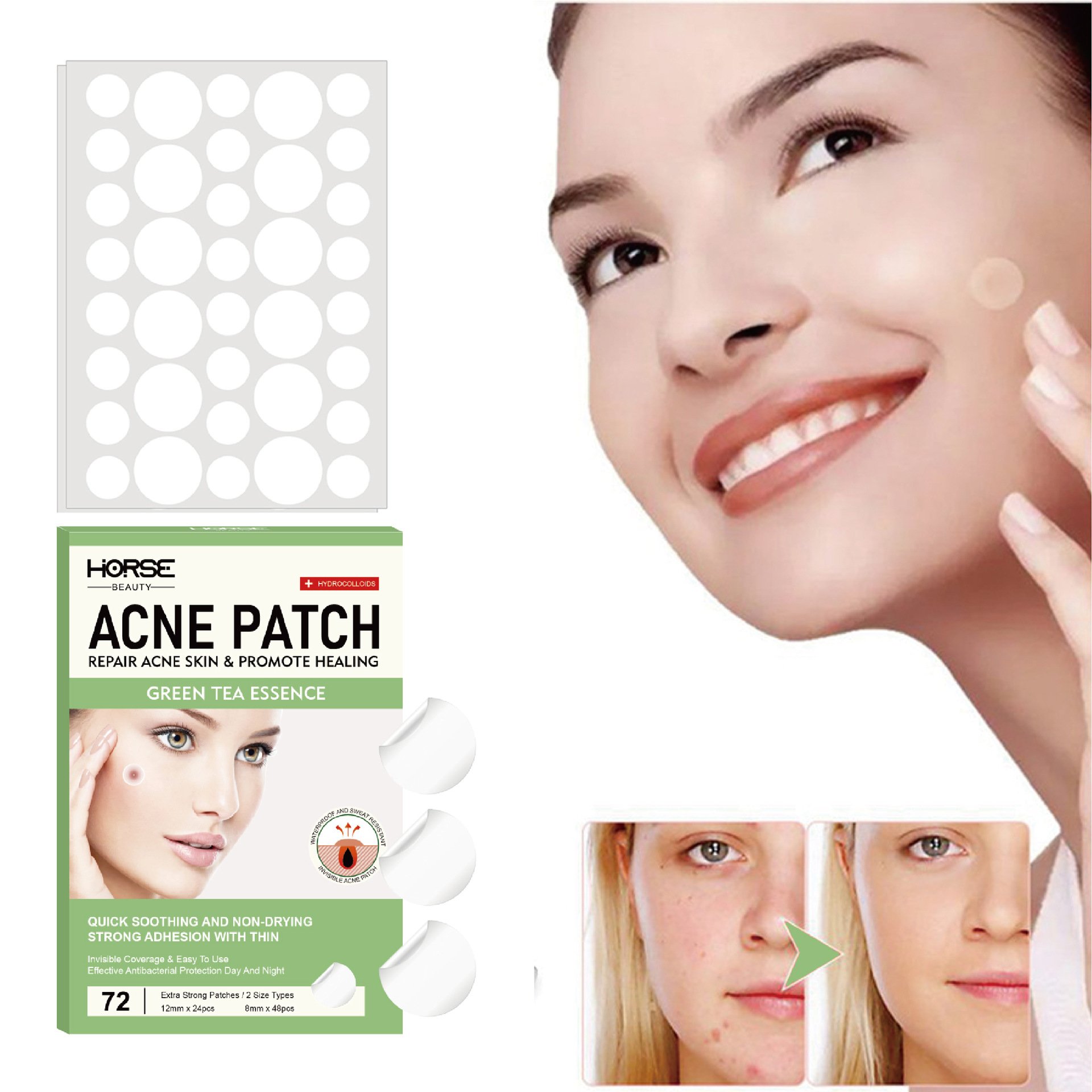 🔥Last Day Promotion 48% OFF-🎁-HORSE Invisible Pimple Patch