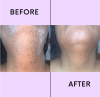 💖LAST DAY 50% OFF-🔥Hair Removal Kit-Buy 1 Get 1 Free