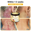 BENDCHARGE™ Bee Essence Skin Treatment Cream (AAD Recommended👨‍⚕️)