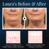 Last Day Promotion 48% OFF - BeautyRest+ Sleeping V-Face Beauty Device