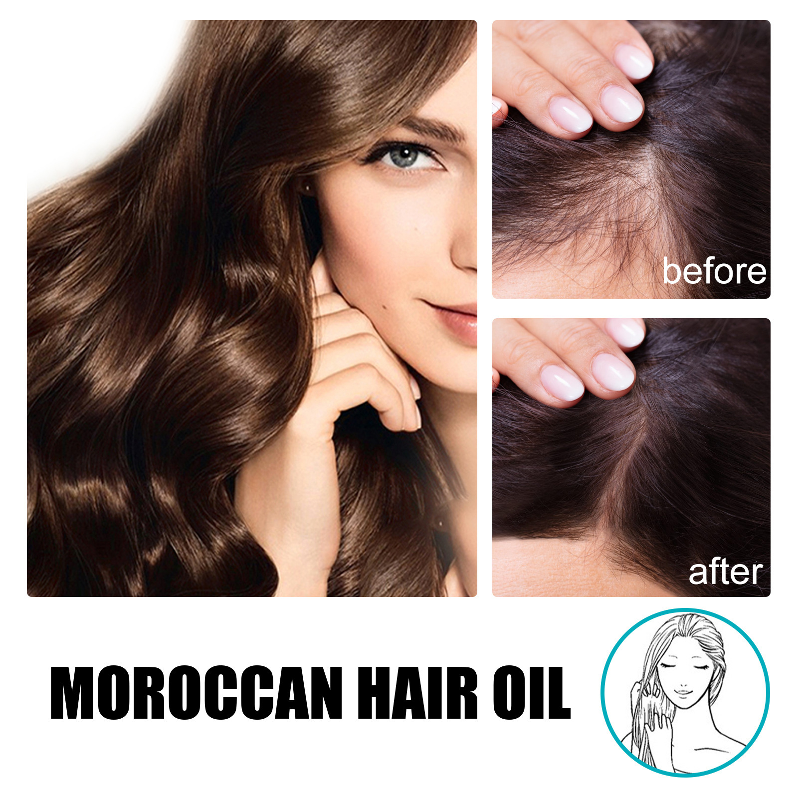 🔥Last Day Promotion 48% OFF-🎁- Hoegoa ZenithGrowth Moroccan Hair Oil