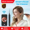 🎁Buy 2 Sets Free Shipping🔥1080P Ear Wax Removal Camera