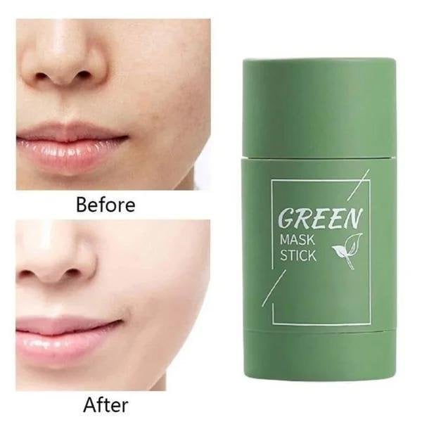 ✨Free shipping-Last Day 75% OFF 🔥-🍵 Deep Cleanse Green Tea Mask