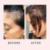 🔥Last Day Promotion 50% OFF🔥Hair Growth Serum